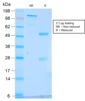 TFF1 Antibody