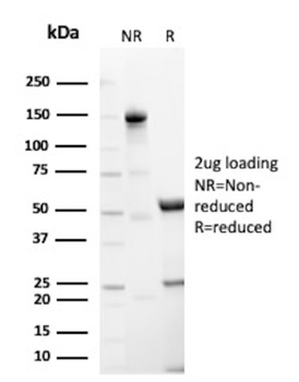 TFF1 Antibody