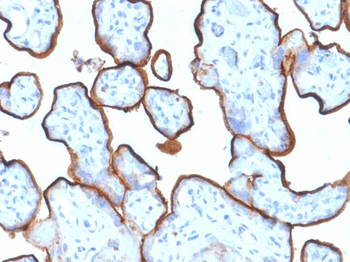 TFRC Antibody