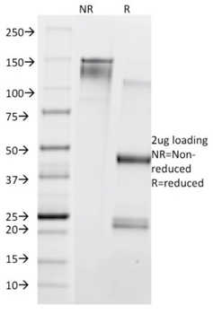 TFRC Antibody