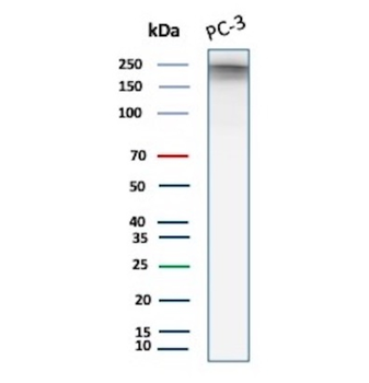 TFRC Antibody
