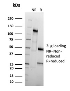 NKX2-1 Antibody