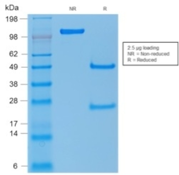 TP53 Antibody
