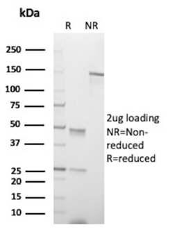 TP53 Antibody