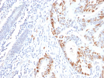 TP53 Antibody