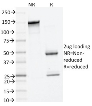 TPSAB1 Antibody