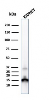 TTR Antibody