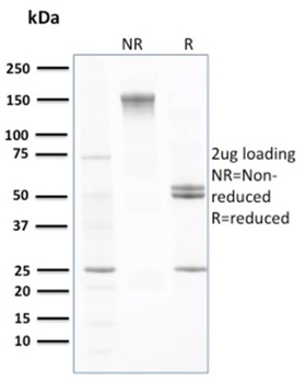 TTR Antibody