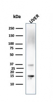 TTR Antibody