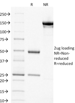 TYMS Antibody
