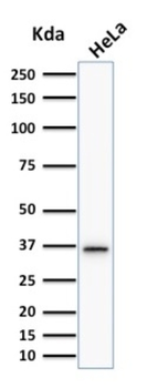 TYMS Antibody