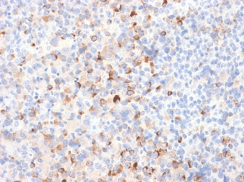 TYR Antibody