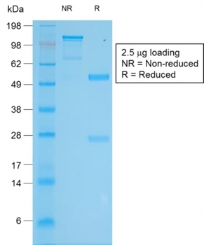 TYR Antibody