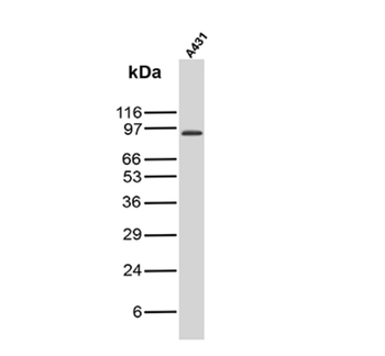 TYR Antibody