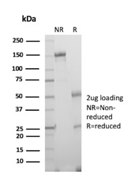 TYR Antibody
