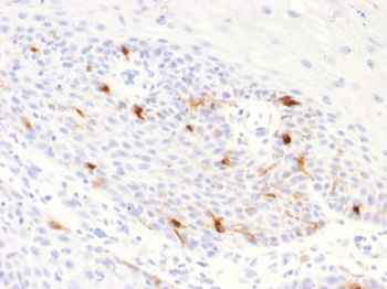 TYRP1 Antibody