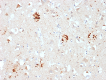 UBB Antibody
