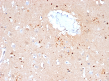UBB Antibody