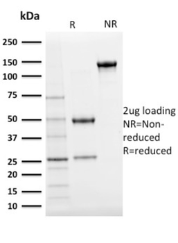 UBB Antibody
