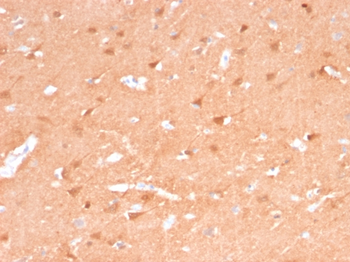 UCHL1 Antibody