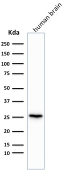 UCHL1 Antibody