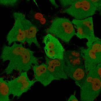 UCHL1 Antibody
