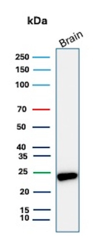 UCHL1 Antibody
