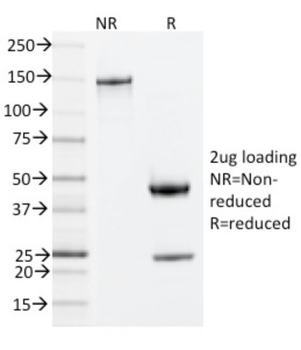 ZAP70 Antibody