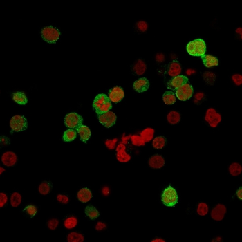 ZAP70 Antibody