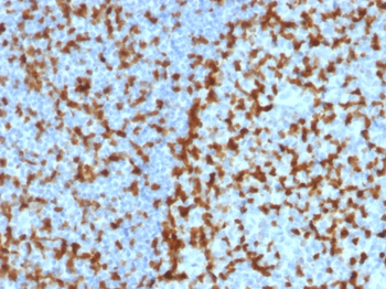 ZAP70 Antibody