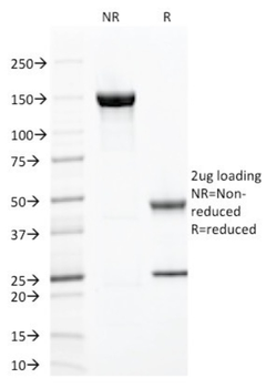 ZAP70 Antibody
