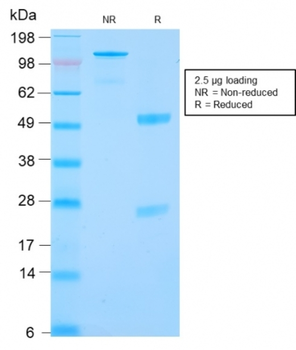 CA9 Antibody
