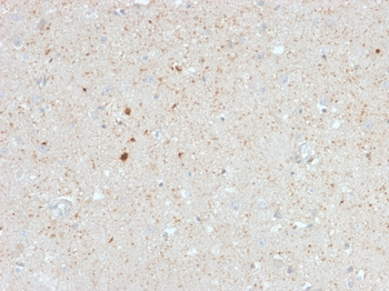 CALB2 Antibody