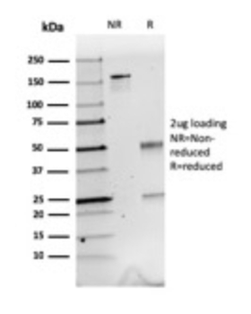 CALB2 Antibody