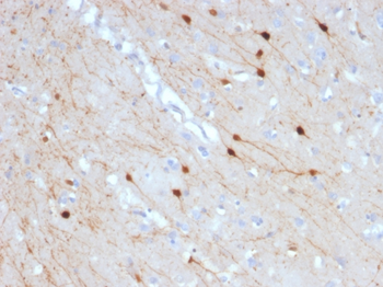 CALB2 Antibody