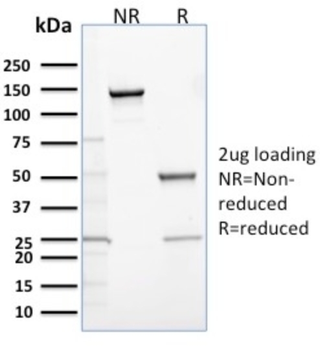CALB2 Antibody