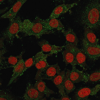 VTCN1 Antibody