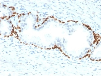 TP63 Antibody