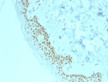 TP63 Antibody