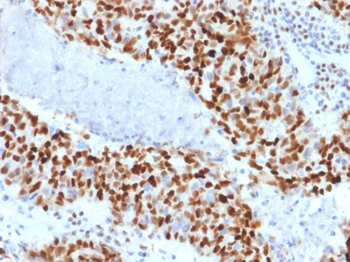 CCNE1 Antibody
