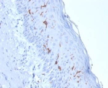 CD1A Antibody
