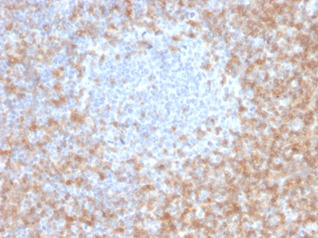 CD5 Antibody