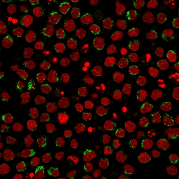 CD5 Antibody