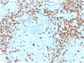 CD5 Antibody