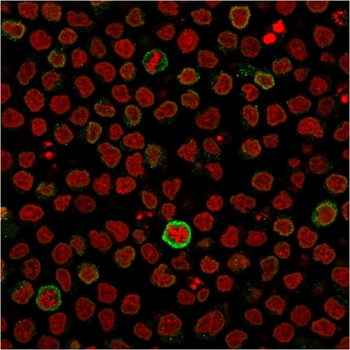 CD5 Antibody