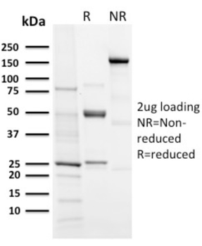 AURKB Antibody