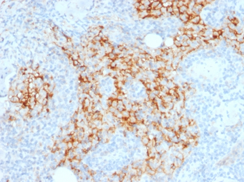 CD14 Antibody