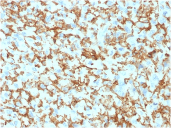 TPSAB1 Antibody