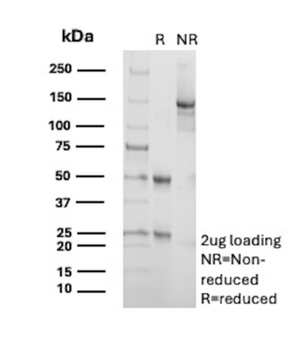 MUC16 Antibody