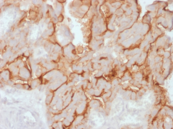 MUC16 Antibody